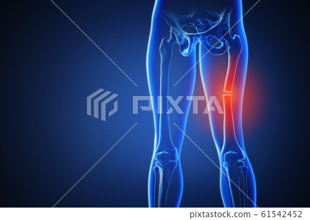 3d rendering of a human body with highlighted...-插圖素材 [61542452] - PIXTA圖庫