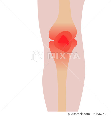 Pain in knee because of injury vector illustration 61567420