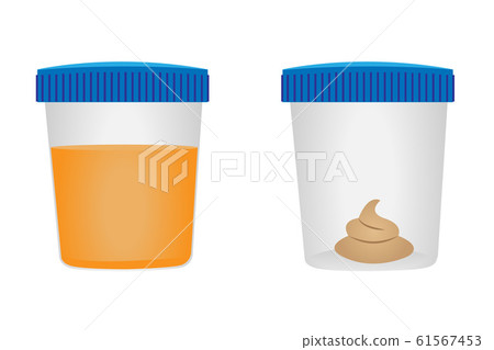 Stool and urina test. Medical examination. Vector illustration Stool and urina test. Medical examination. Vector illustration 61567453