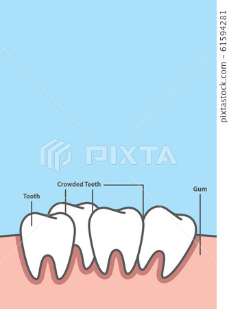 Blank banner Crowding tooth frame cartoon style Blank banner Crowding tooth frame cartoon style 61594281