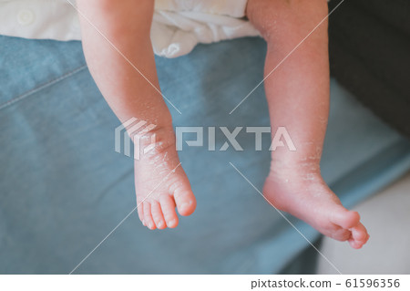 Day 10 10 days after birth 61596356