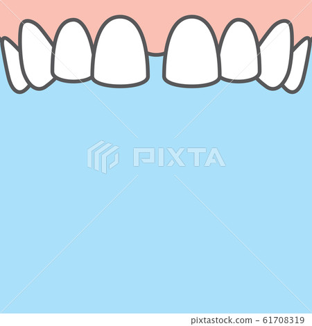 Blank banner Upper Diastema teeth illustration Blank banner Upper Diastema teeth illustration 61708319