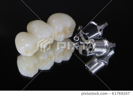 CAD / CAM全陶瓷 61769267