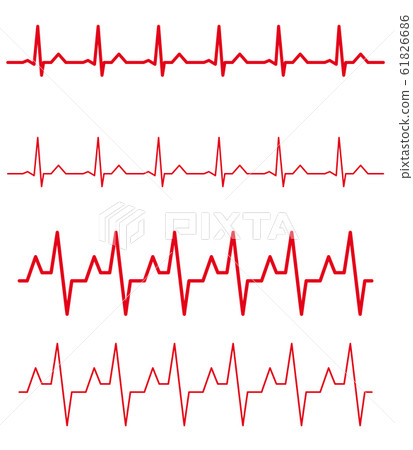 心電圖節律變化集 61826686