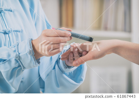 Therapist doing moxa treatment Therapist doing moxa treatment 61867443