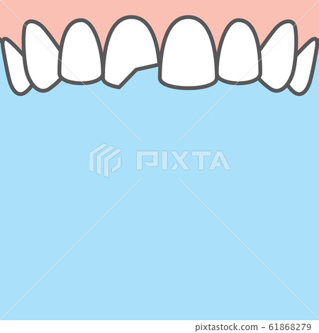 Blank banner Upper Chipped tooth illustration Blank banner Upper Chipped tooth illustration 61868279
