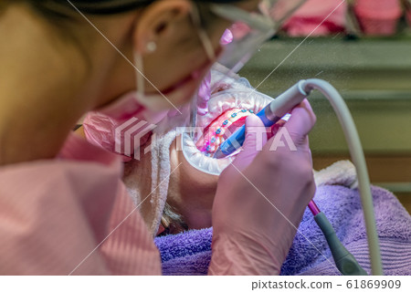 Young kid with braces and cheek retractor. Dentist cleaning dental plaque 61869909