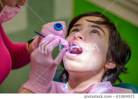 Young kid with braces and cheek retractor. Dentist cleaning dental plaque Young kid with braces and cheek retractor. Dentist cleaning dental plaque 61869915