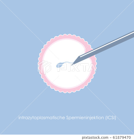 fertility reproduction of ovum and spermatozoon ICSI fertility reproduction of ovum and spermatozoon ICSI 61879470