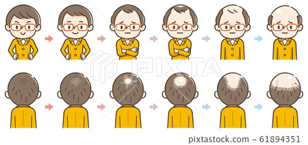 脫髮的進展 61894351