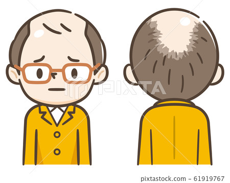 Men who grieve for thinning hair 61919767