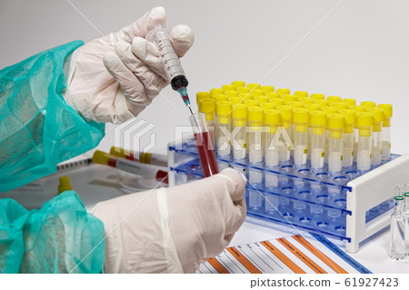 Coronavirus 2019-nCoV world outbreak tests on microbiology lab. Coronavirus 2019-nCoV world outbreak tests on microbiology lab. 61927423