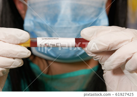 Coronavirus 2019-nCoV world outbreak tests on microbiology lab. Coronavirus 2019-nCoV world outbreak tests on microbiology lab. 61927425