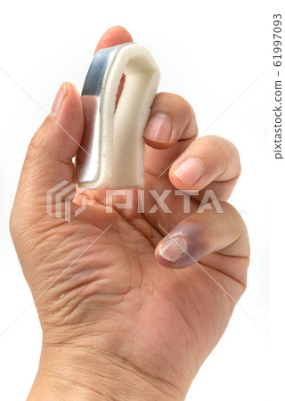 Little finger cast Little finger cast 61997093