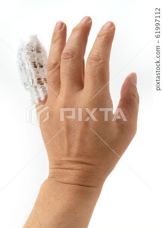 Little finger cast 61997112