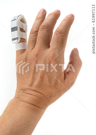 Little finger cast 61997113