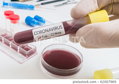Hand holds test tube with blood for Coronavirus 2019-nCOV analysis. 62007969