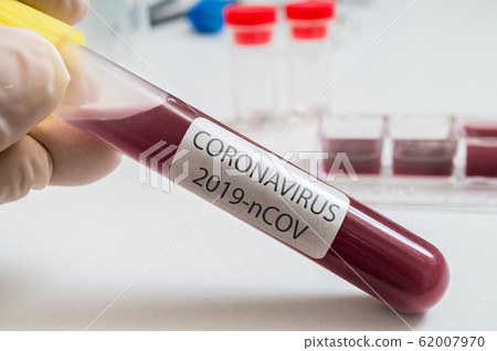 Hand holds test tube for Coronavirus 2019-nCOV analysis. 62007970