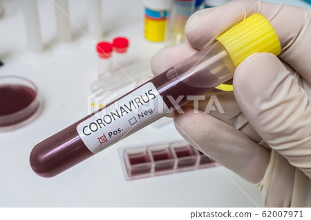 Hand holds test tube for Coronavirus 2019-nCOV analysis. 62007971