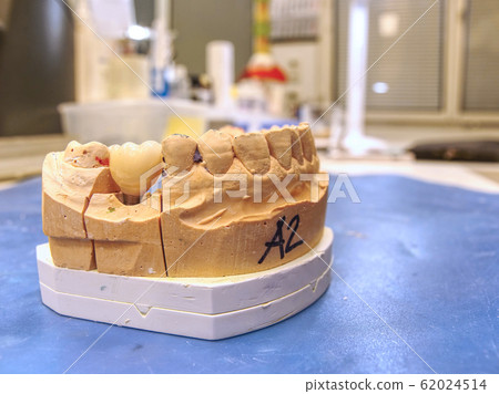 Dental prosthesis in semiprocess. Test of 62024514