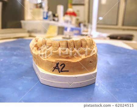 Metal-ceramic dental crown is tried on an gypsum Metal-ceramic dental crown is tried on an gypsum 62024515