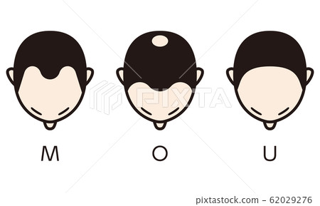 Hamilton Norwood Classification Bald Hamilton Norwood Classification Bald 62029276