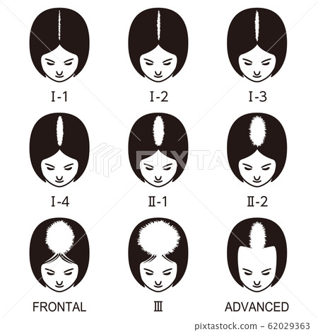 Ludwig's Classification Bald 62029363