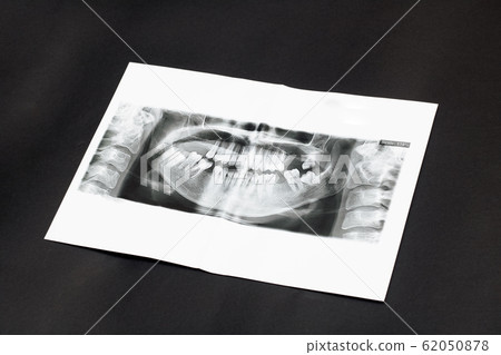 Panoramic picture of the jaw on black background 62050878