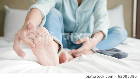 applying cream for athletes foot applying cream for athletes foot 62093380