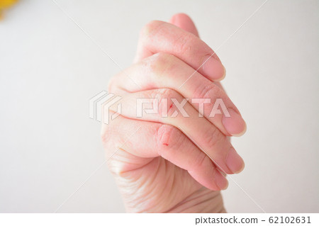 女人的干手 62102631