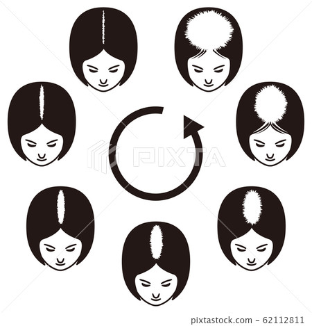 The progress of thinning hair 62112811