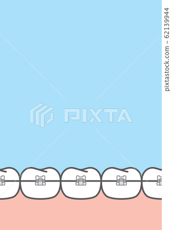 Blank banner clear braces teeth Blank banner clear braces teeth 62139944