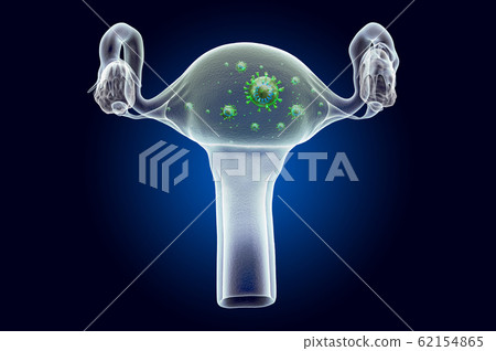 Uterus with virus, ghost light effect 62154865