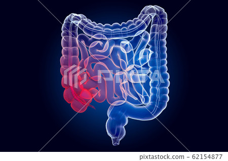 Pain in human intestines, bowel concept Pain in human intestines, bowel concept 62154877