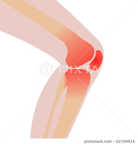 Pain in knee because of injury 62199918