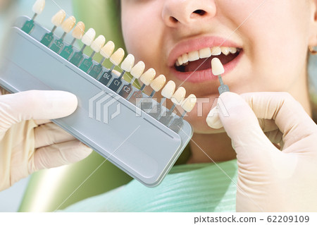 Beautiful smile and white teeth of a young woman. Matching the shades of the implants or the process of teeth whitening. Teeth palette. Beautiful smile and white teeth of a young woman. Matching the shades of the implants or the process of teeth whitening. Teeth palette. 62209109