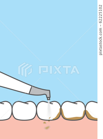 Blank banner Air flow stain removal and teeth Blank banner Air flow stain removal and teeth 62225102