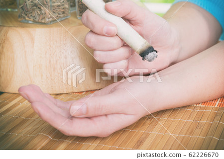 Hand with professional moxa sticks Hand with professional moxa sticks 62226670