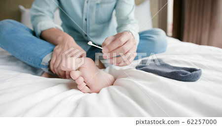 applying cream for athletes foot 62257000