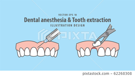 Dental anesthesia,a syringe injecting to gums & 62268308