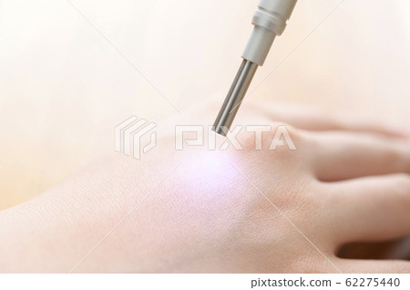 皮膚測量圖像 62275440