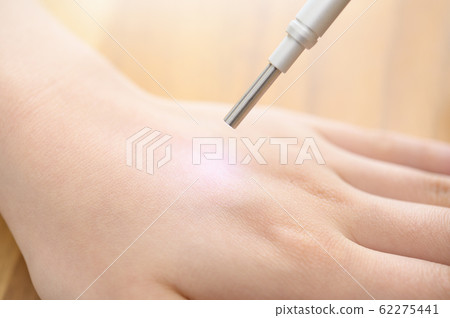 皮膚測量圖像 62275441