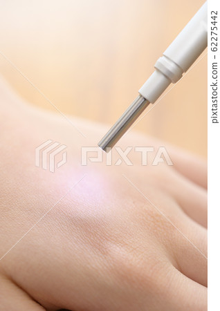 皮膚測量圖像 62275442