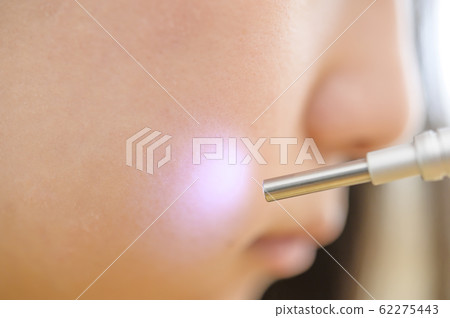 Skin measurement image 62275443