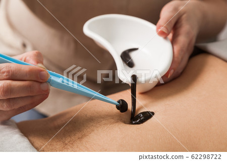 the doctor puts a leech tweezers on a stomach of the person the doctor puts a leech tweezers on a stomach of the person 62298722