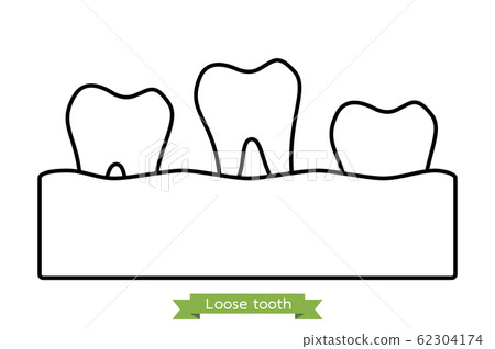 loose tooth, tooth is fall out of the gum 62304174