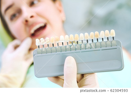 Beautiful smile and white teeth of a young woman. Matching the shades of the implants or the process of teeth whitening. Teeth palette. 62304593