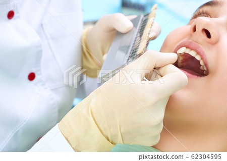 Beautiful smile and white teeth of a young woman. Matching the shades of the implants or the process of teeth whitening. Teeth palette. 62304595