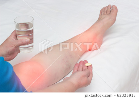 A woman whose leg pain in the joints holds a pill and a glass of water. The concept of treatment of arthritis and arthrosis with anti-inflammatory drugs, vitamins and chondroprotectors 62323913