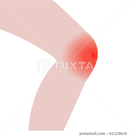 Knee pain 62329628